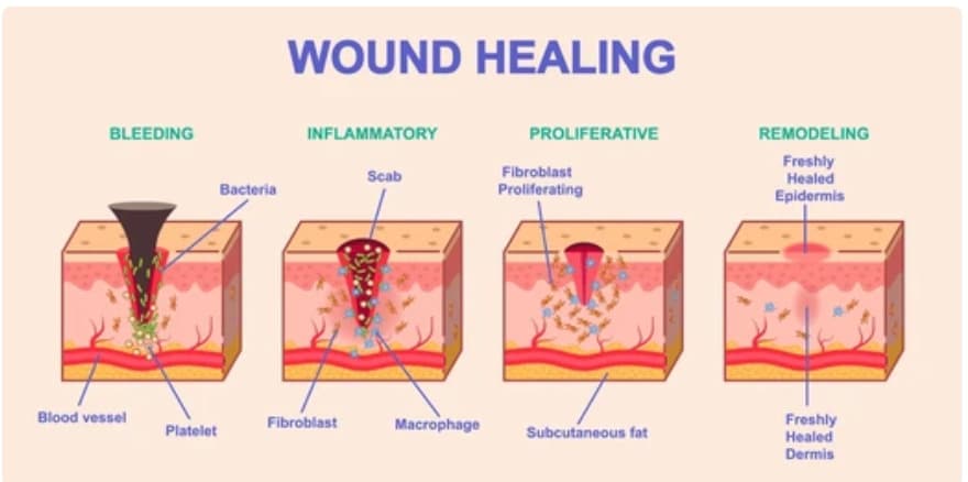 Physician caring for wound patient